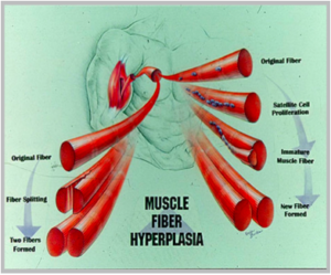 Hyperplasie